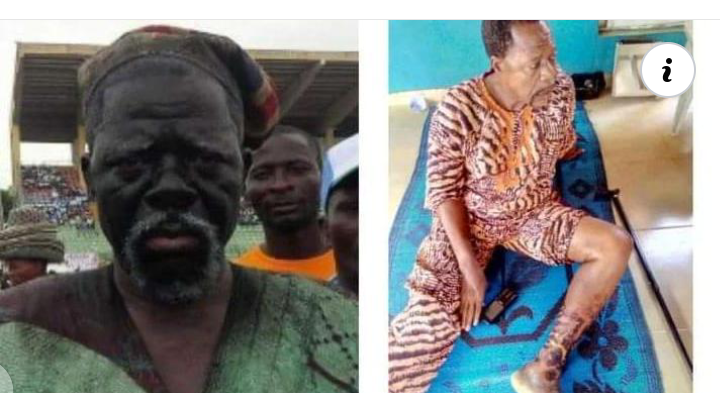 Fadeyi Oloro, A veteran actor appeals to Nigerians for financial assistance to help him recover from health issues .